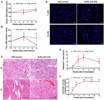 Gene Expression Profiling of Lacrimal Glands Identifies the Ectopic Expression of MHC II on Glandular Cells as a Presymptomatic Feature in a Mouse Model of Primary Sjögren's Syndrome